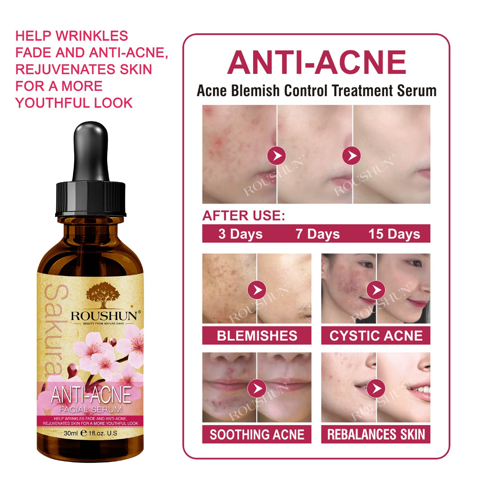 ROUSHUN Sakura Anti-Acne Facial Serum Help Wrinkles Fade And Anti-Acne Rejuvenates Skin 